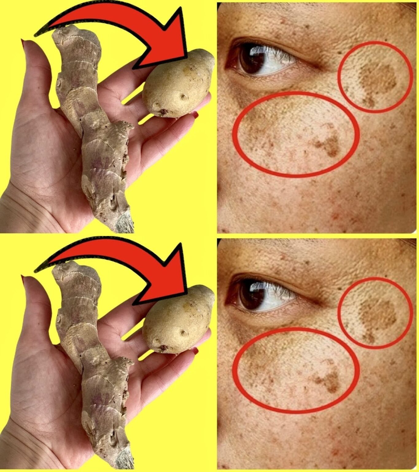A simple and safe method to get rid of stains on the face and hands